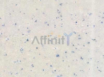 PGP9.5 Recombinant Rabbit mAb - BF3435 at 1/100 staining Human brain tissue by IHC-P.