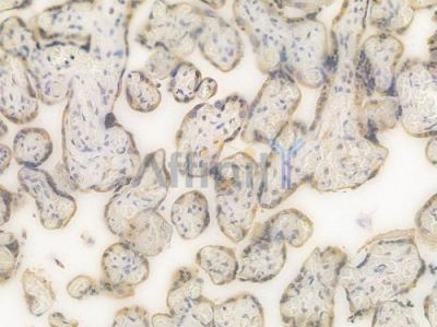 BAD Recombinant Rabbit mAb - BF3439 at 1/100 staining Human placental tissue by IHC-P.