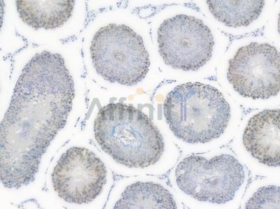 RAD51 Recombinant Rabbit mAb - BF3442 at 1/100 staining Rat testicular tissue by IHC-P.