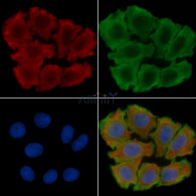 Wnt5a Recombinant Rabbit mAb - BF3448 staining Hela cells(30min of UV treatment) by IF/ICC.