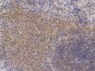 NRF1 Recombinant Rabbit mAb - BF3456 at 1/100 staining Rat spleen tissue by IHC-P.