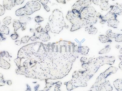 NRF1 Recombinant Rabbit mAb - BF3456 at 1/100 staining Human placental tissue by IHC-P.