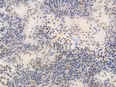 NRF1 Recombinant Rabbit mAb - BF3456 at 1/100 staining Human lymph node tissue by IHC-P.