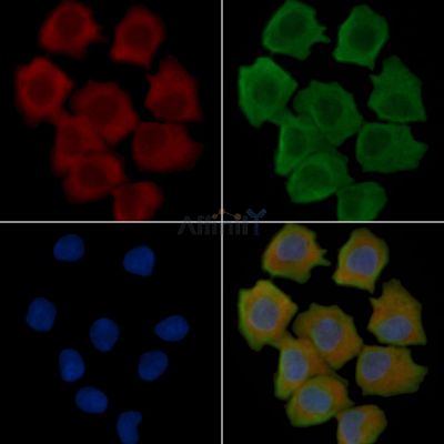 CXCL14 Recombinant Rabbit mAb - BF3465 staining Hela cells(30min of UV treatment) by IF/ICC.