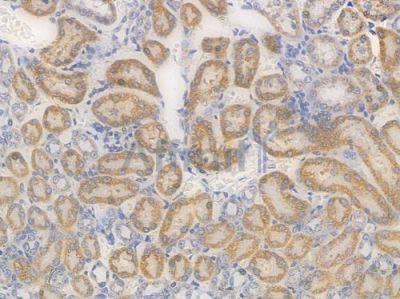 Catalase Recombinant Rabbit mAb - BF3479 at 1/100 staining Mouse renal tissue by IHC-P.