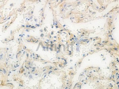 PKC alpha Recombinant Rabbit mAb - BF3505 at 1/100 staining Human lung tissue by IHC-P.