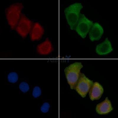 HLA-DRA Recombinant Rabbit mAb - BF3510 staining Hela cells(30min of UV treatment) by IF/ICC.