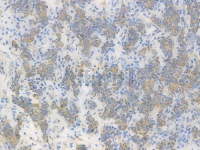 Integrin  alpha V Recombinant Rabbit mAb - BF3511 at 1/100 staining Human gastric tissue by IHC-P.
