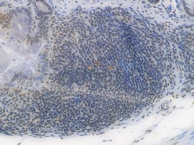 SP1 Recombinant Rabbit mAb - BF3512 at 1/100 staining Mouse rectal tissue by IHC-P.