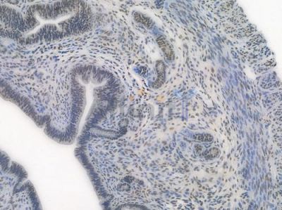 SP1 Recombinant Rabbit mAb - BF3512 at 1/100 staining Mouse uterine tissue by IHC-P.