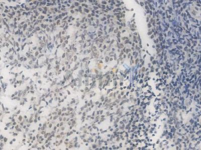 SP1 Recombinant Rabbit mAb - BF3512 at 1/100 staining Human tonsil tissue by IHC-P.