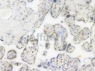 SP1 Recombinant Rabbit mAb - BF3512 at 1/100 staining Human placental tissue by IHC-P.