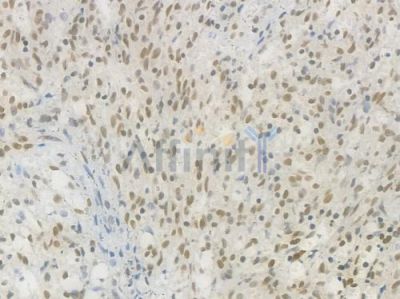 SP1 Recombinant Rabbit mAb - BF3512 at 1/100 staining Human spleen tissue by IHC-P.