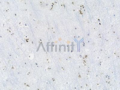 SP1 Recombinant Rabbit mAb - BF3512 at 1/100 staining Human brain tissue by IHC-P.