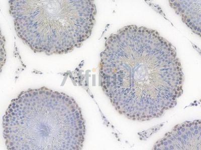 SP1 Recombinant Rabbit mAb - BF3512 at 1/100 staining Rat lung tissue by IHC-P.