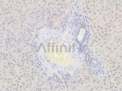 SP1 Recombinant Rabbit mAb - BF3512 at 1/100 staining Rat liver tissue by IHC-P.