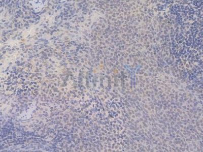 SP1 Recombinant Rabbit mAb - BF3512 at 1/100 staining Rat spleen tissue by IHC-P.