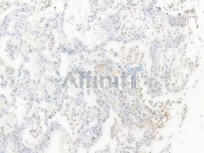 SP1 Recombinant Rabbit mAb - BF3512 at 1/100 staining Human lung tissue by IHC-P.