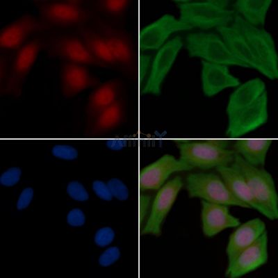 FRA1 Recombinant Rabbit mAb - BF3513 staining Hela cells(30min of UV treatment) by IF/ICC.