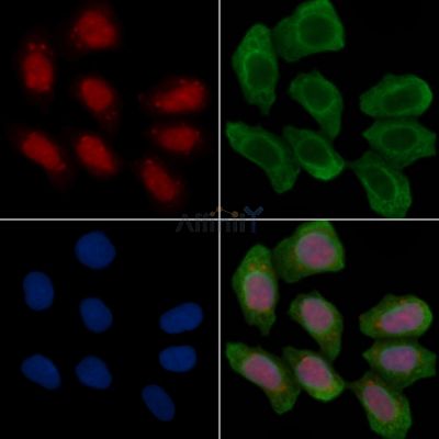 HDAC1 Recombinant Rabbit mAb - BF3527 staining Hela cells(30min of UV treatment) by IF/ICC.