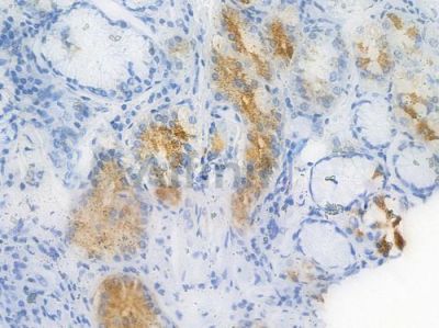 AXIN2 Recombinant Rabbit mAb - BF3543 at 1/100 staining Human gastric tissue by IHC-P.