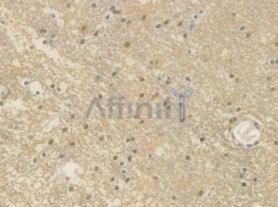 S100B Recombinant Rabbit mAb - BF3545 at 1/100 staining Human brain tissue by IHC-P.