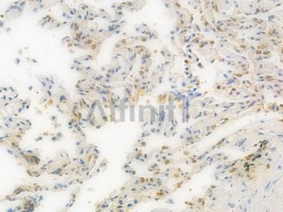 ENO1 Recombinant Rabbit mAb - BF3552 at 1/100 staining Human lung tissue by IHC-P.