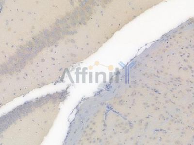 GSK3 alpha Recombinant Rabbit mAb - BF3553 at 1/100 staining Mouse brain tissue by IHC-P.