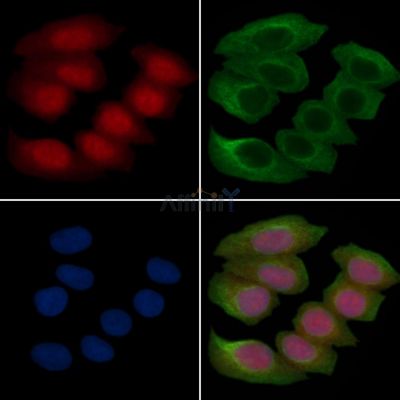 GSK3 alpha/ beta Recombinant Rabbit mAb - BF3554 staining Hela cells(30min of UV treatment) by IF/ICC.