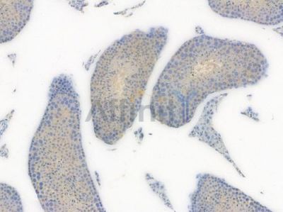 GSK3 alpha/ beta Recombinant Rabbit mAb - BF3554 at 1/100 staining Mouse testicular tissue by IHC-P.