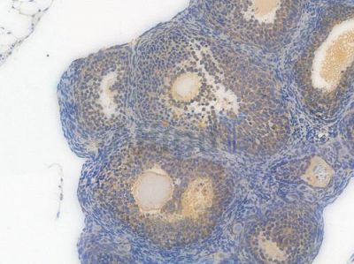 Phospho-GSK3 (alpha/beta) (Tyr279/Tyr216) Recombinant Rabbit mAb - BF3555 at 1/100 staining Mouse ovarian tissue by IHC-P.