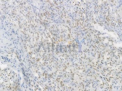 PFKFB3 Recombinant Rabbit mAb - BF3558 at 1/100 staining Human spleen tissue by IHC-P.