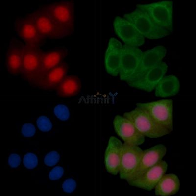 Blimp-1 Recombinant Rabbit mAb - BF3561 staining Hela cells(30min of UV treatment) by IF/ICC.