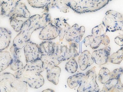 Cox1 Recombinant Rabbit mAb - BF3565 at 1/100 staining Human placental tissue by IHC-P.