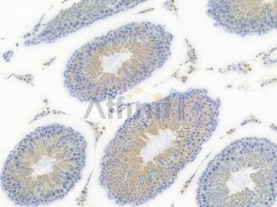 GPX1 Recombinant Rabbit mAb - BF3592 at 1/100 staining Rat testicular tissue by IHC-P.