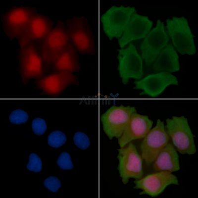 5 Lipoxygenase Recombinant Rabbit mAb - BF3599 staining Hela cells(30min of UV treatment) by IF/ICC.