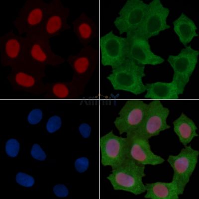 HDAC2 Recombinant Rabbit mAb - BF3604 staining Hela cells(30min of UV treatment) by IF/ICC.