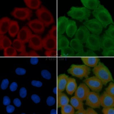 ACACB Recombinant Rabbit mAb - BF3605 staining Hela cells(30min of UV treatment) by IF/ICC.