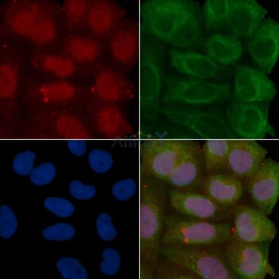 KLF4 Recombinant Rabbit mAb - BF3606 staining Hela cells(30min of UV treatment) by IF/ICC.