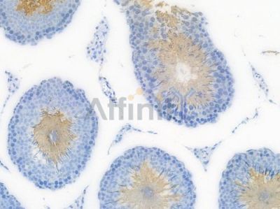 Choline Acetyltransferase Recombinant Rabbit mAb - BF3610 at 1/100 staining Rat testicular tissue by IHC-P.
