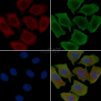 PDCD6IP Recombinant Rabbit mAb - BF3611 staining Hela cells(30min of UV treatment) by IF/ICC.