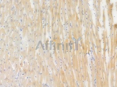 Phospholamban Recombinant Rabbit mAb - BF3613 at 1/100 staining Rat heart tissue by IHC-P.