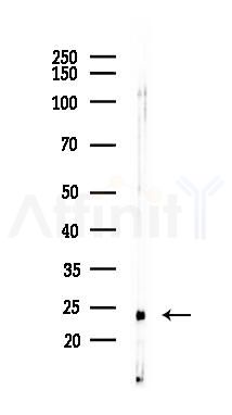 Phospholamban Recombinant Rabbit mAb - Western blot analysis of lysates from Rat heart, using Phospholamban Recombinant Rabbit mAb at 1/1000 dilution.
