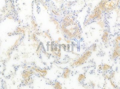 CLU Recombinant Rabbit mAb - BF3627 at 1/100 staining Human lung tissue by IHC-P.