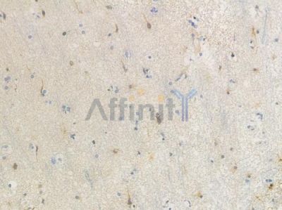 CLU Recombinant Rabbit mAb - BF3627 at 1/100 staining Human brain tissue by IHC-P.