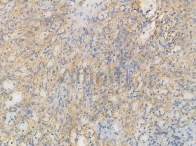Bak Recombinant Rabbit mAb - BF3633 at 1/100 staining Human spleen tissue by IHC-P.