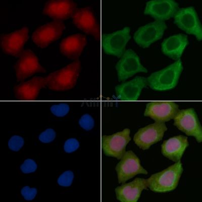 HDAC3 Recombinant Rabbit mAb - BF3650 staining Hela cells(30min of UV treatment) by IF/ICC.