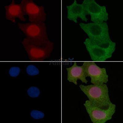 FTO Recombinant Rabbit mAb - BF3679 staining Hela cells(30min of UV treatment) by IF/ICC.