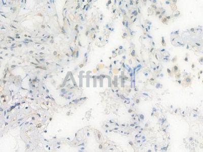 FTO Recombinant Rabbit mAb - BF3679 at 1/100 staining Human lung tissue by IHC-P.