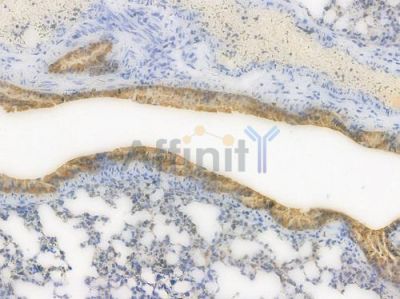 ALDH1A1 Recombinant Rabbit mAb - BF3691 at 1/100 staining Mouse lung tissue by IHC-P.